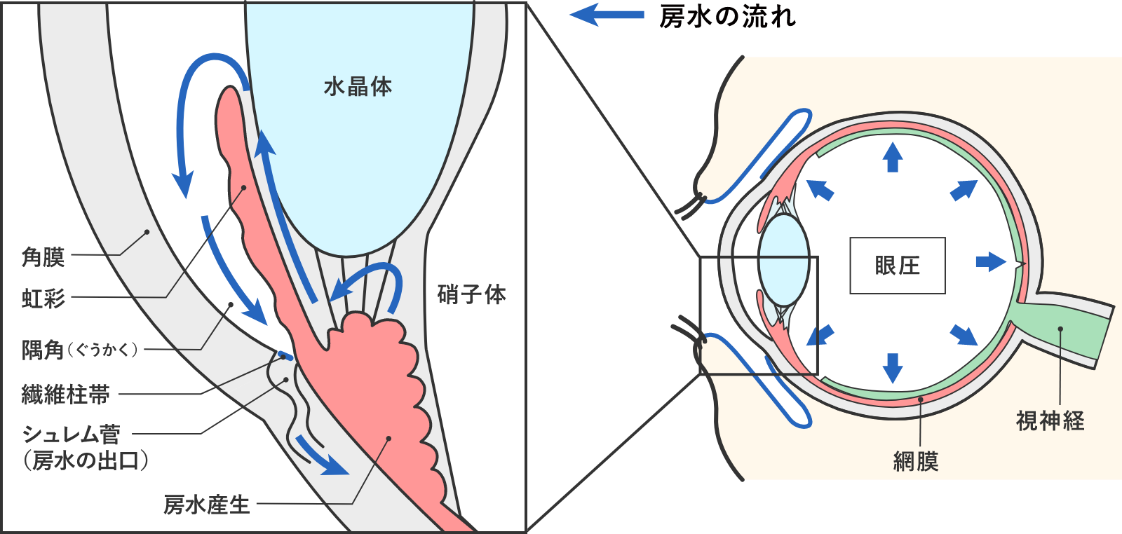 緑内障