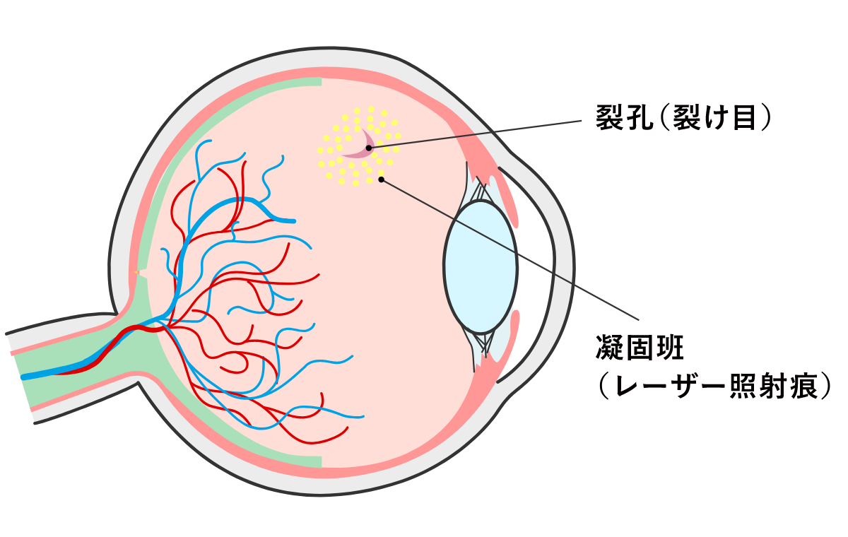 図15
