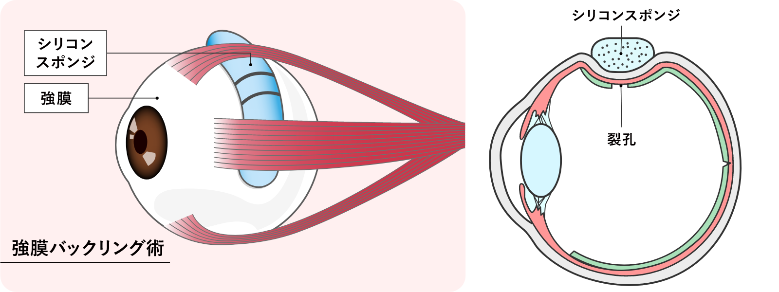 図16