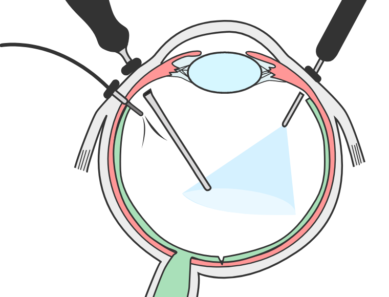 図17