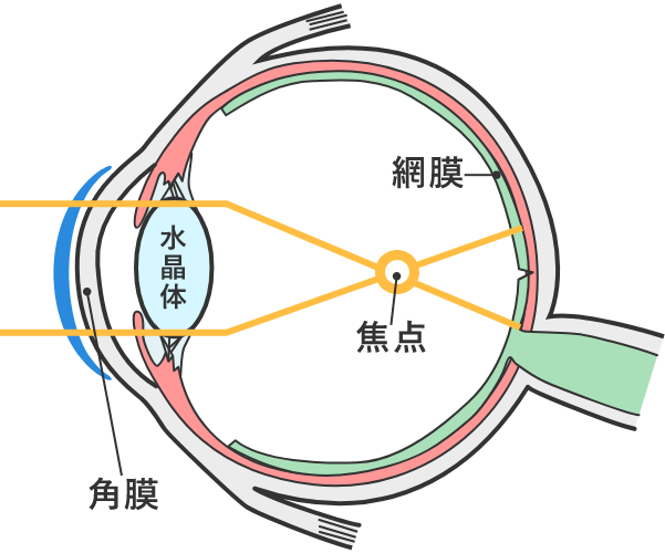 近視の状態