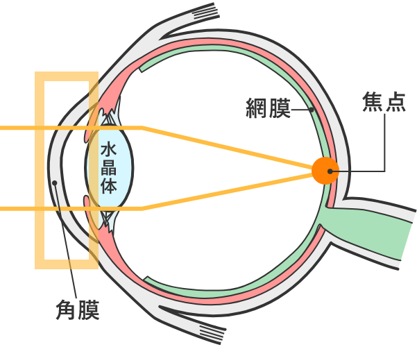昼:レンズをはずした後