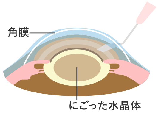 図１