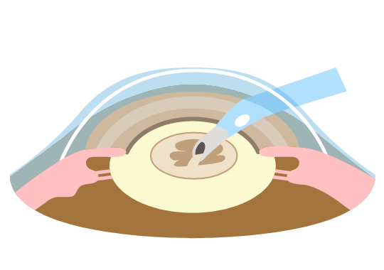 図２