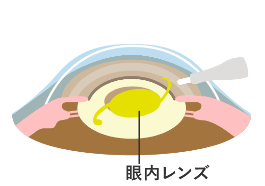 図３