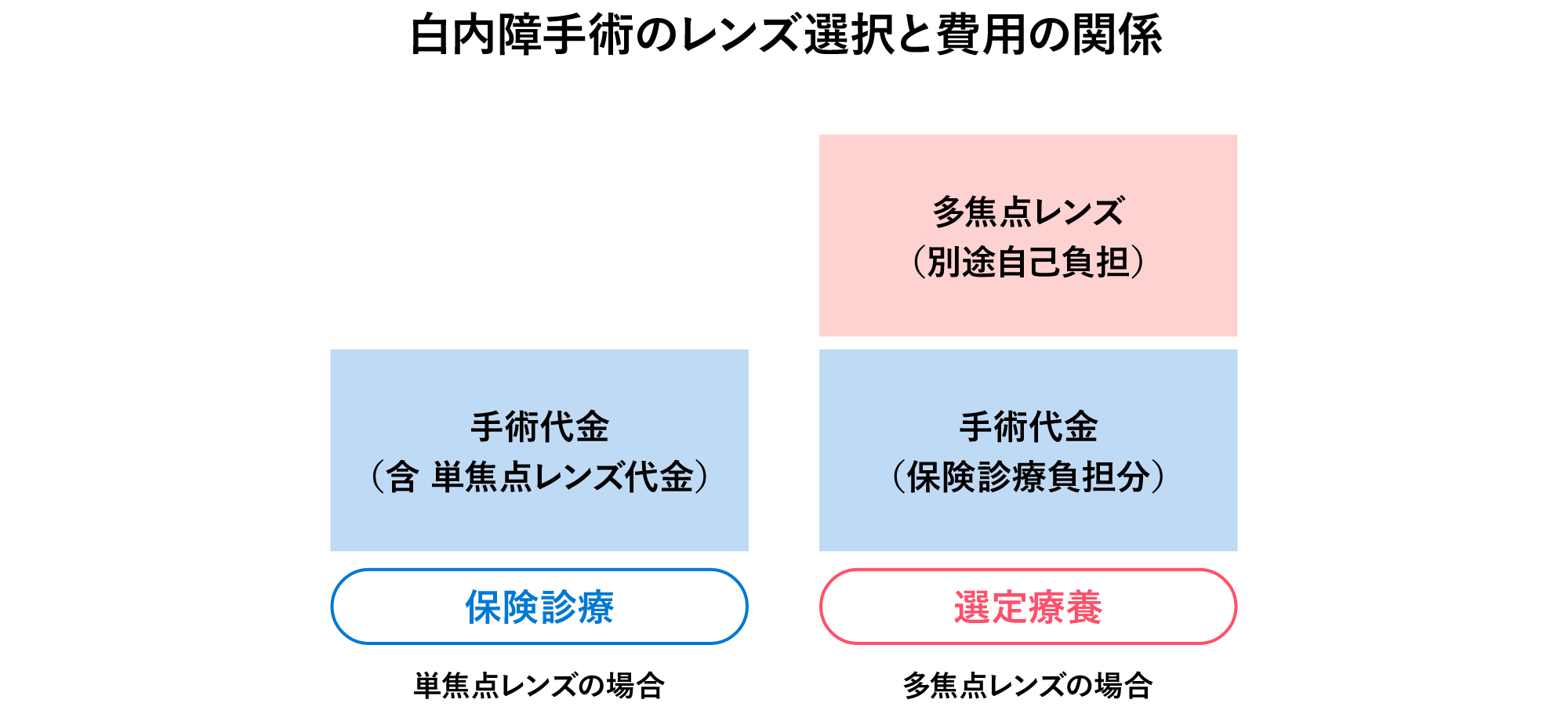白内障手術のレンズ選択と費用の関係